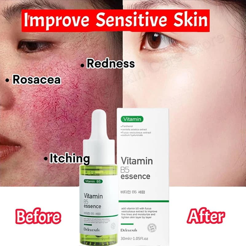 Sérum Réparateur Anti-Rougeurs Visage – Améliore la Peau Sensible et la Sécheresse – Hydratant Apaisant – Élimine la Rosacée – Cosmétiques Coréens