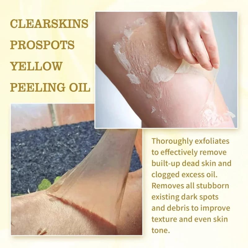 Lotion éclaircissante forte à l'huile de peeling jaune pour peaux foncées