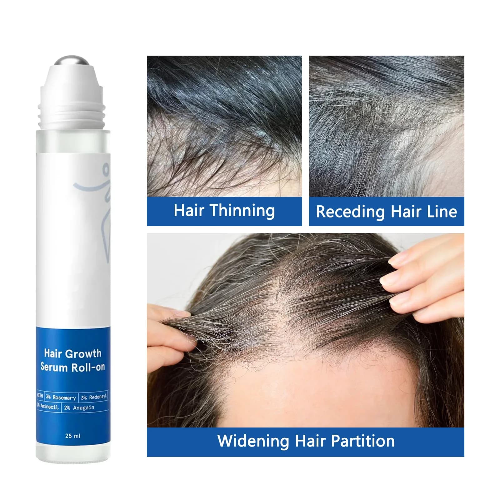 Sérum pour la croissance et l'épaississement des cheveux - Réduit la chute