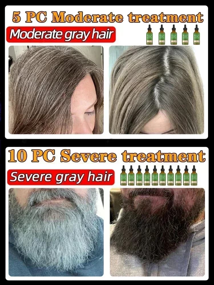 Sérum liquide de traitement des cheveux gris et blancs pour hommes et femmes, réparation de documents naturels, empêche le blanc en noir, nouveau