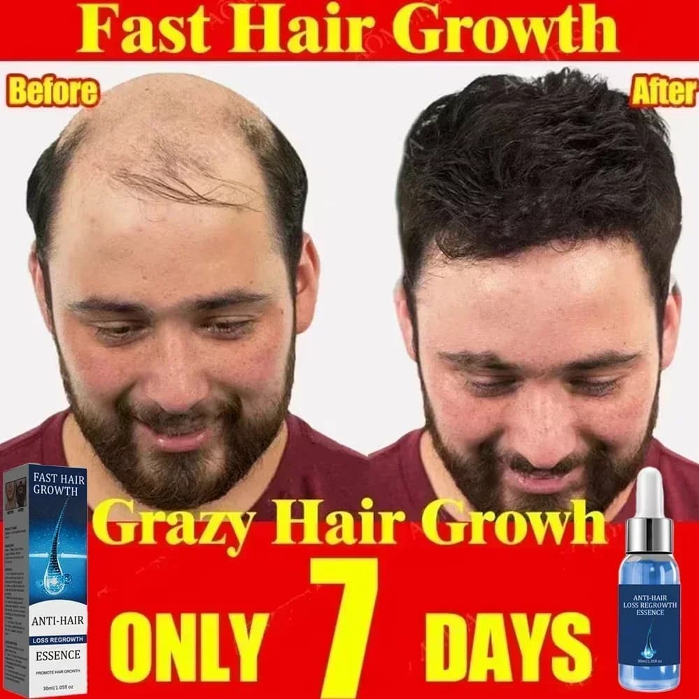 Traitement Essentiel de Repousse et de Croissance des Cheveux