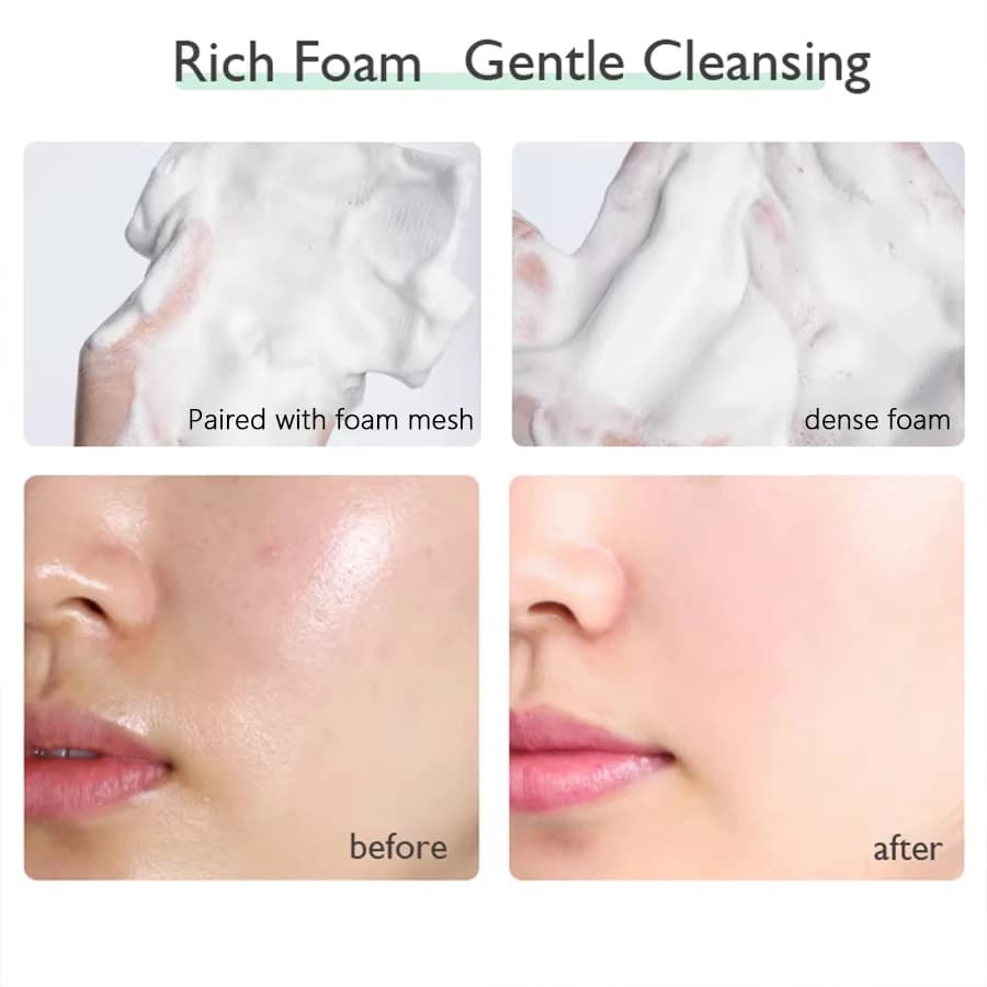 PTWOP blanchissant nettoyant pour le visage mousse hydratant en profondeur nettoyant acné lait contrôle de l'huile exfoliant rétrécissement des Pores lavage du visage