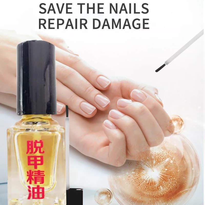 Liquide réparateur pour ongles, huile essentielle pour soins des pieds, enrichie en nutriments, pour ongles endommagés, doux et brillants, pour la protection des ongles, 5 pièces