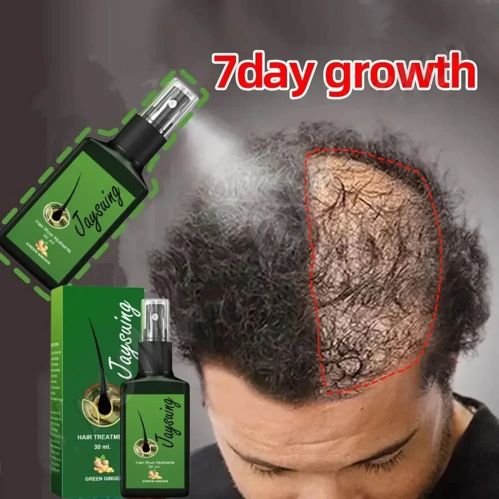 Spray rapide pour la croissance des cheveux au gingembre, Anti-chute des racines, sérum pour la repousse des cheveux, réparation endommagée du cuir chevelu, produits de soins nourrissants pour femmes 