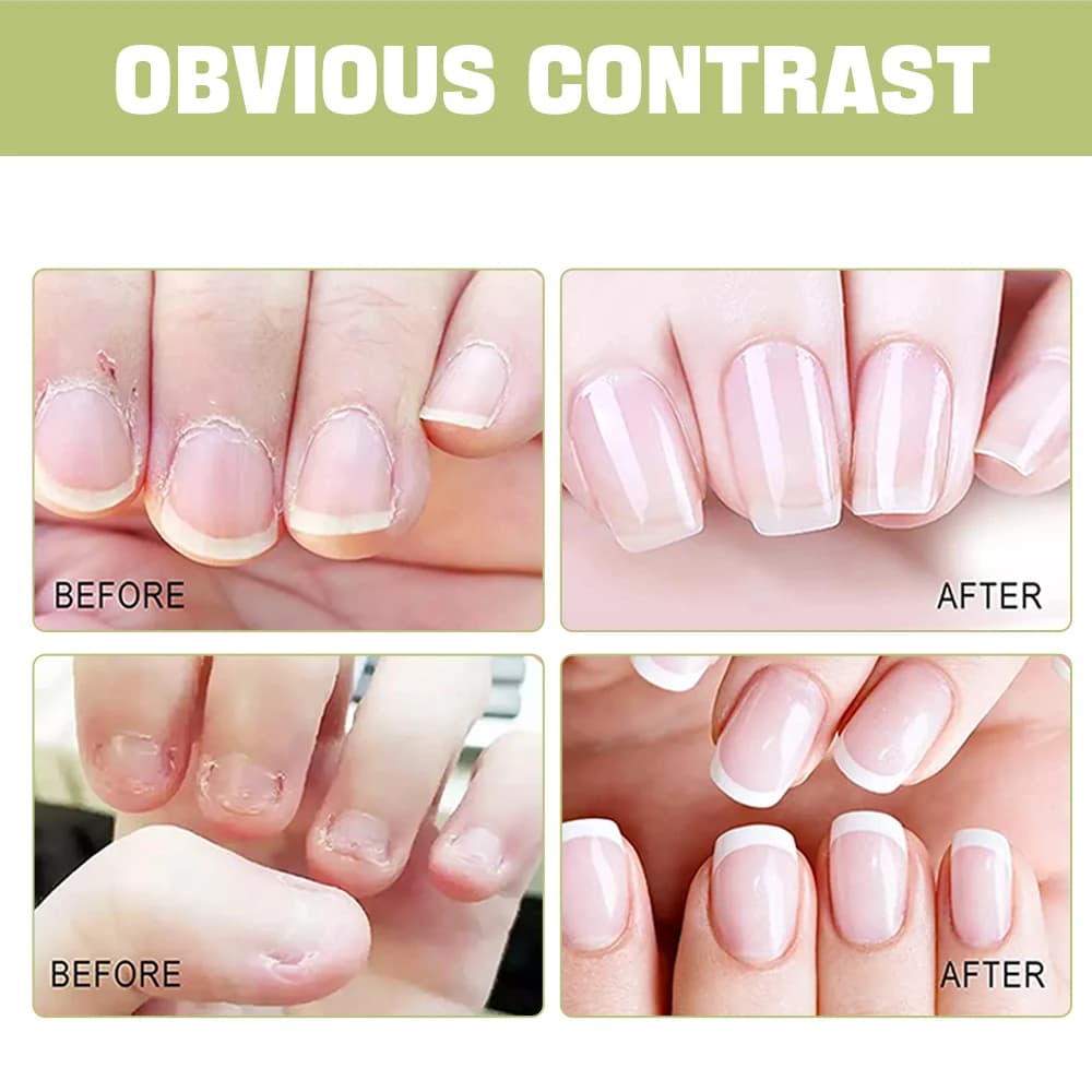Huile pour cuticules EJW – Nourrit et protège les ongles