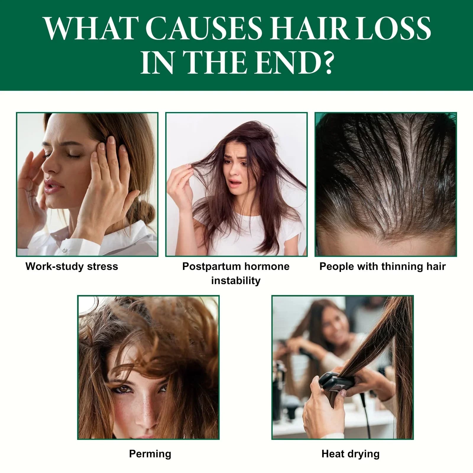 Fluide anti-chute de cheveux au gingembre 30ml - Combat la calvitie, stimule les follicules et nourrit le cuir chevelu, solution de soin capillaire intensive.