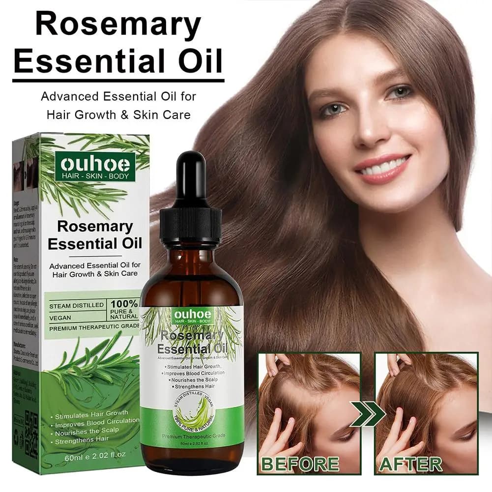 Huile de romarin pour la croissance des cheveux, huile essentielle de noix de coco, améliore la perte de cheveux et nourrit, renforce les racines des cheveux, traitement du cuir chevelu, soins capilla