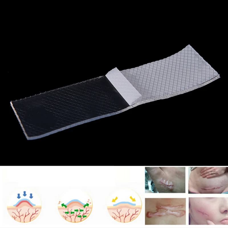 1PC Patch en silicone réutilisable pour la réparation cutanée, traitement des cicatrices, des traumatismes, des brûlures et de l'acné, Nouveau