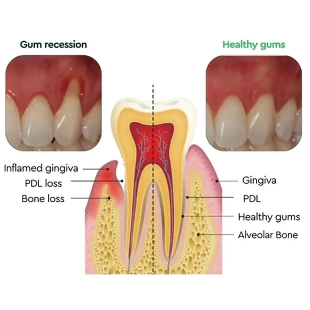 Gouttes réparatrices naturelles pour les gencives, améliorent la santé gingivale, soulagent l'inconfort buccal et renforcent les gencives lâches, produit de soins dentaires quotidiens