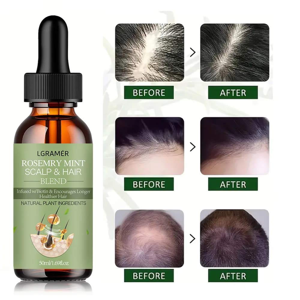 Huile essentielle pour la croissance des cheveux