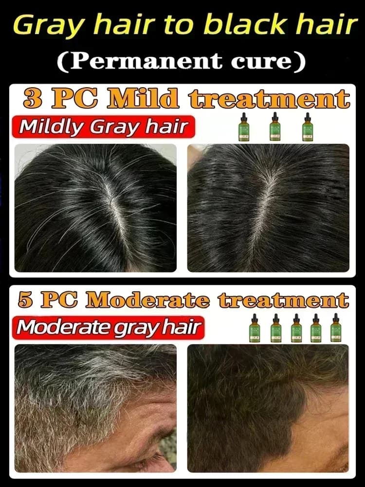 Sérum liquide de traitement des cheveux gris et blancs pour hommes et femmes, réparation de documents naturels, empêche le blanc en noir, nouveau