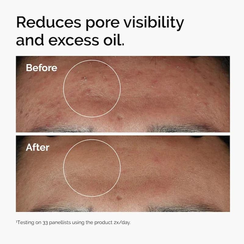 Niacinamide 10% + Zinc 1% sérum 30ml améliore la luminosité de la peau renforcer la barrière contre l'humidité de la peau améliore la texture réduit l'excès d'huile
