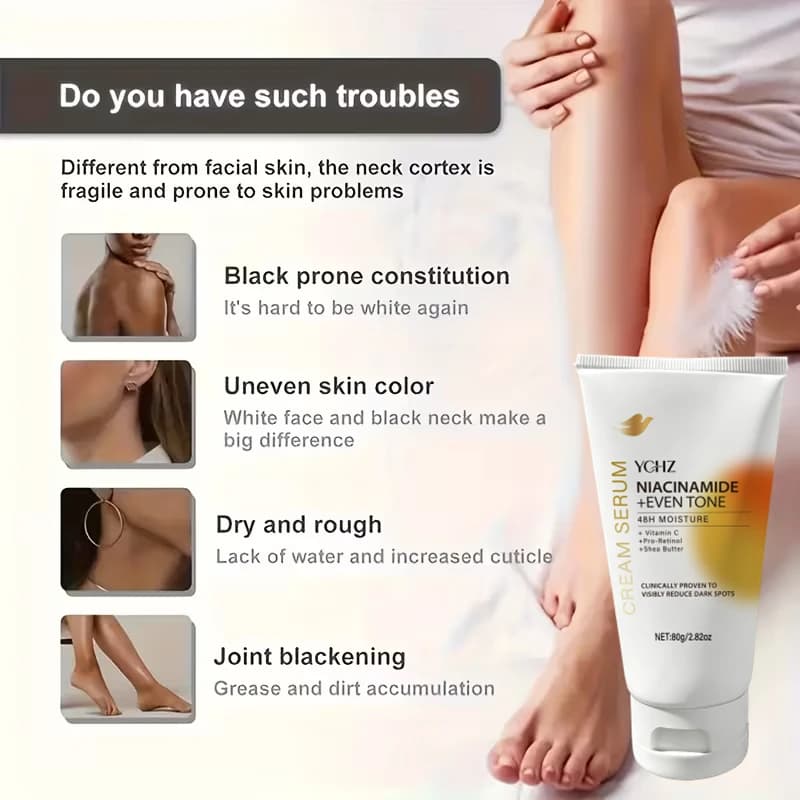 Crème éclaircissante pour le visage et le corps - Crème éclaircissante et unifiante - Non grasse, convient aux hommes et aux femmes - Crème blanchissante et hydratante, pour une utilisation de jour et