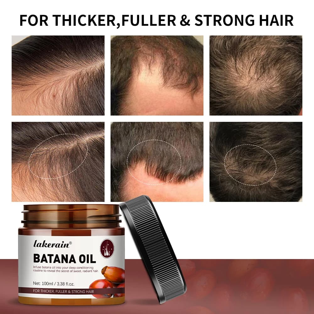 Huile de Batana non raffinée pour la croissance des cheveux, brute, pour améliorer l'efficacité, la force de l'UNICEF, hydrater les feuilles, ajouter de l'humidité et de la nutrition