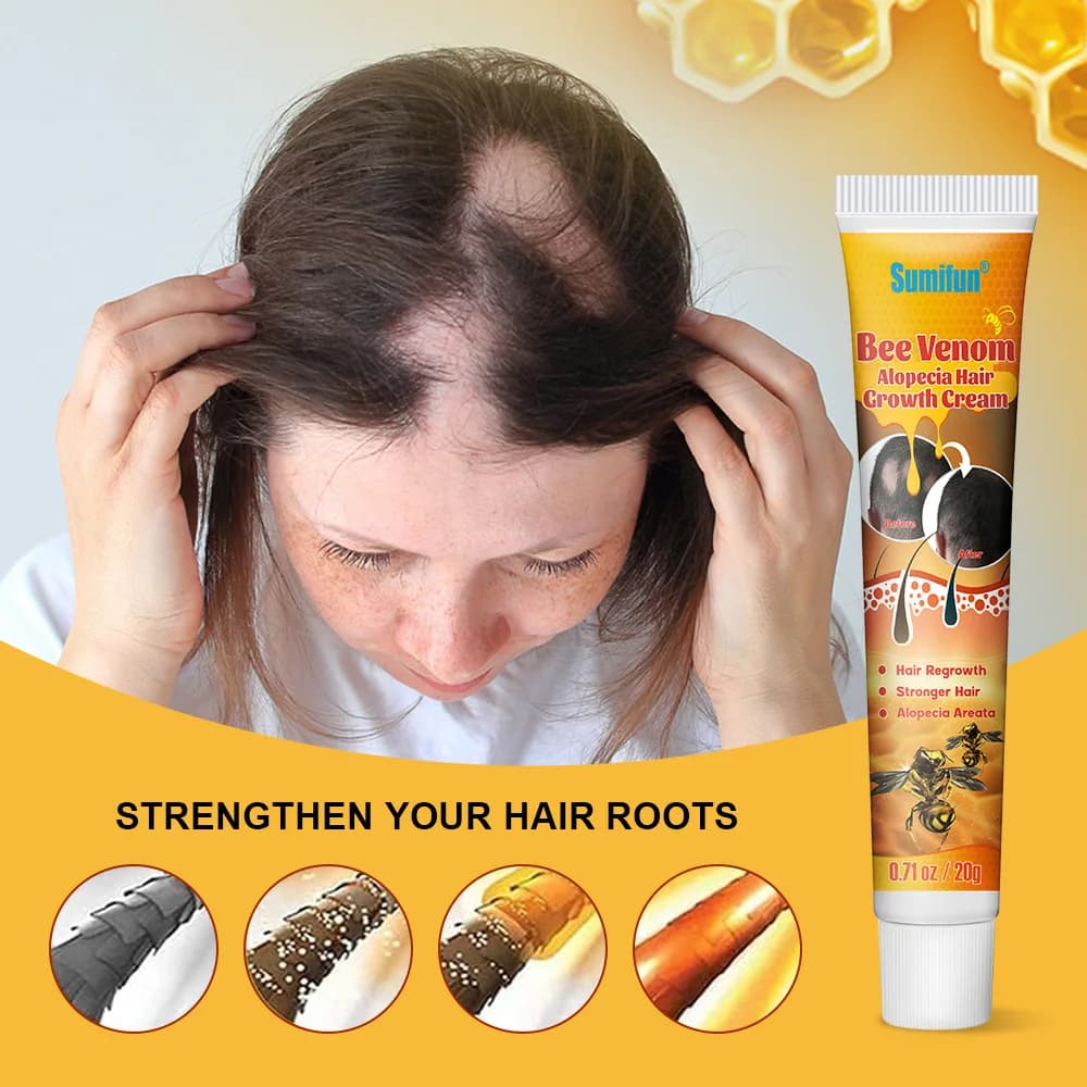 Crème sérum pour la croissance des cheveux, Capsule essentielle pour une repousse rapide, Anti-chute de cheveux, Traitement de la calvitie, Réduit les dommages du cuir chevelu, Pour femmes et hommes