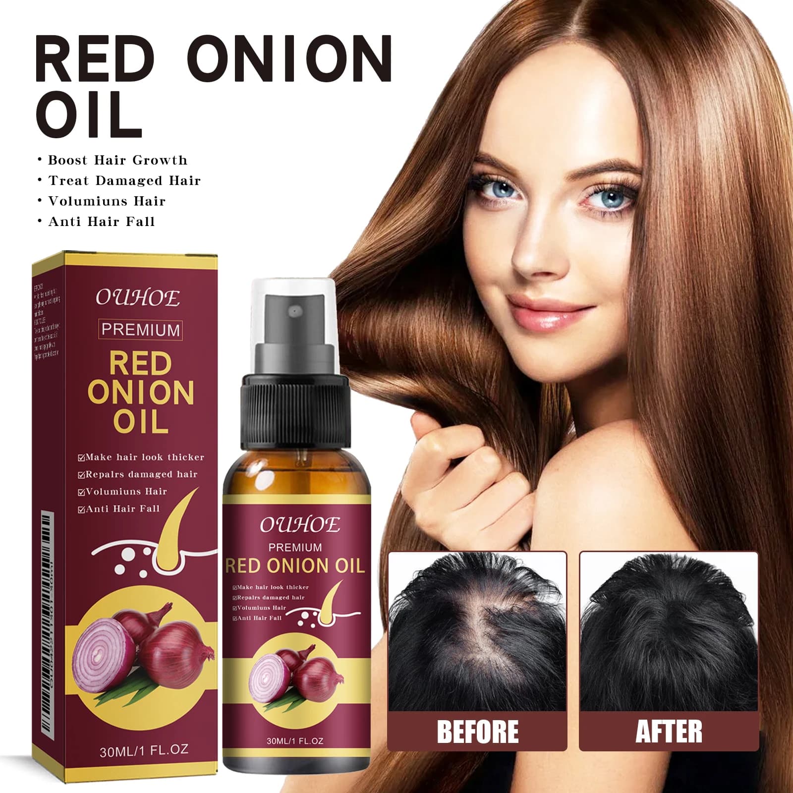 Huile essentielle pour la croissance des cheveux à l'oignon rouge, spray pour soins capillaires, prévient la perte de cheveux, nourrit les racines des cheveux, améliore la texture des cheveux, produit