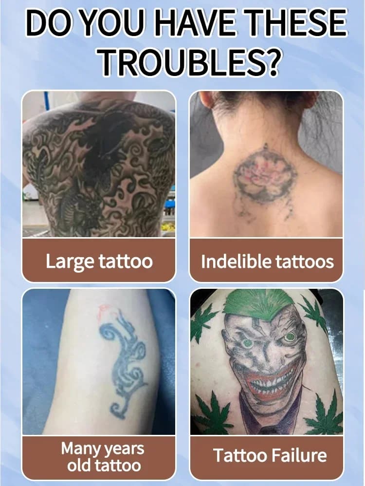 Huile essentielle pour détatouage, adaptée aux tatouages grands et petits, élimine efficacement les tatouages permanents