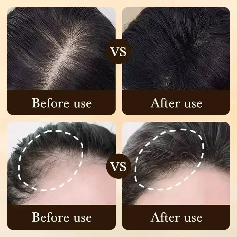 Faites-tu veux dire au revoir à la chute des cheveux? Nos produits peuvent pénétrer les follicules pileux et aider vos