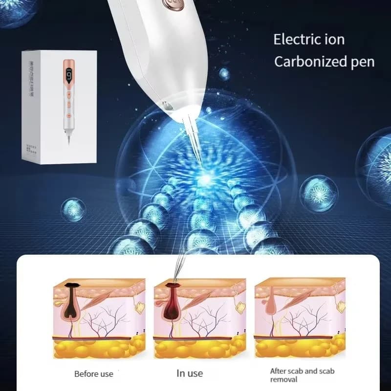 Stylo Cosmétique Laser à Micro-Aiguilles Électriques, Technologie de Satisfaction Lonisée, pour la Maison et la miles