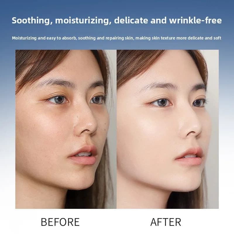 Sérum à l'acide hyaluronique, Anti-âge, hydratant, rétrécit les Pores, Essence blanchissante hydratante pour Instruments à micro-aiguilles, soins pour la peau