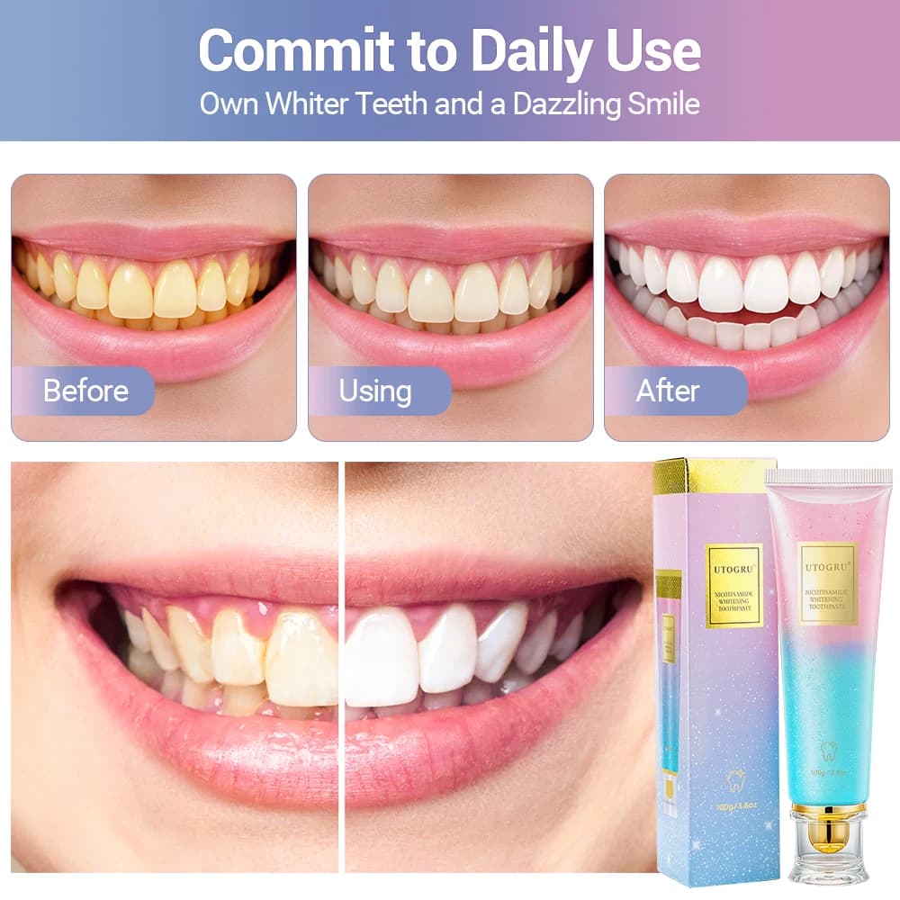 La dentifrice blanchissant les dents élimine efficacement les taches de thé