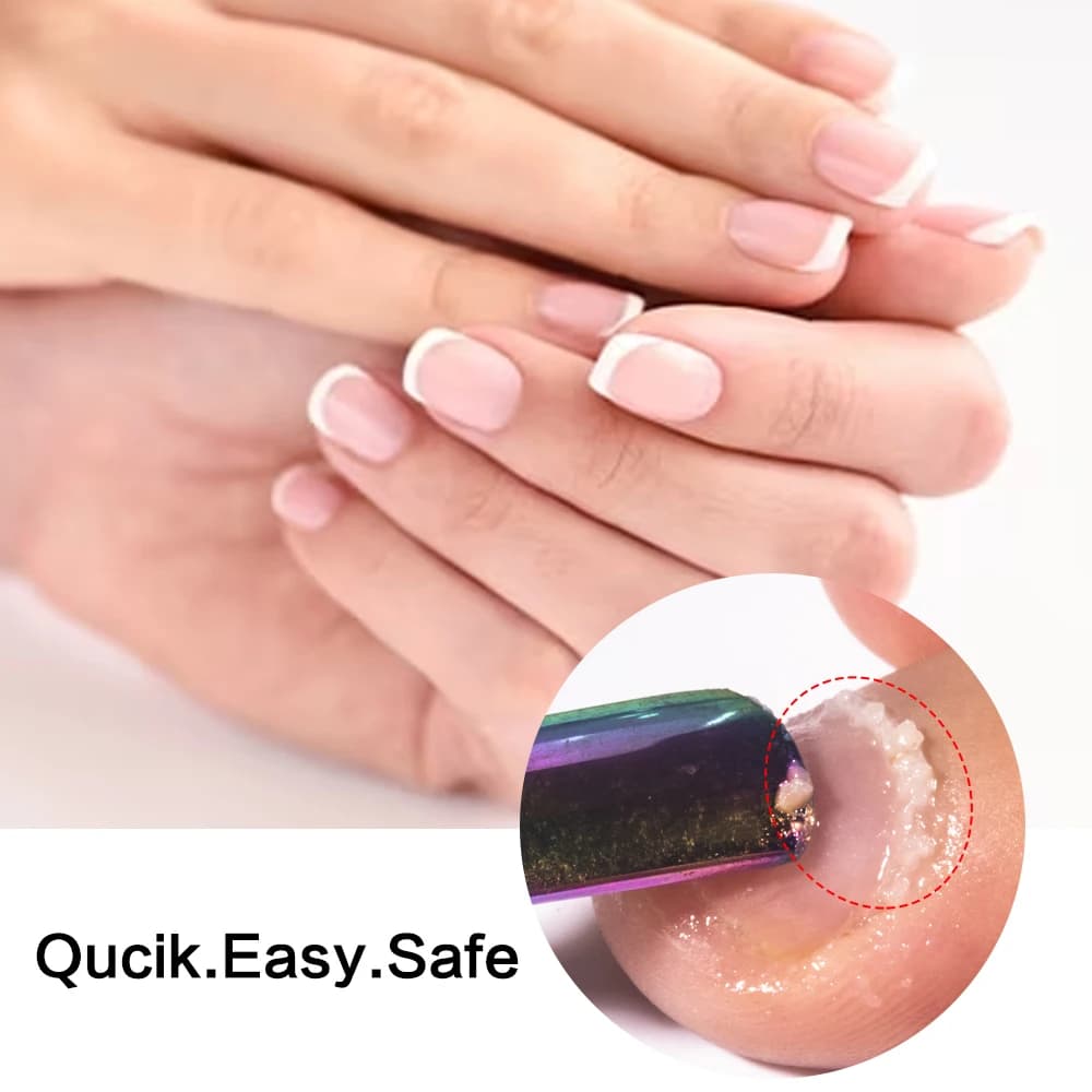 KODIES GEL dissolvant de cuticules 15ML exfoliant doux pied cuticule huile adoucisseur liquide traitement des ongles manucure réparation outils de soins