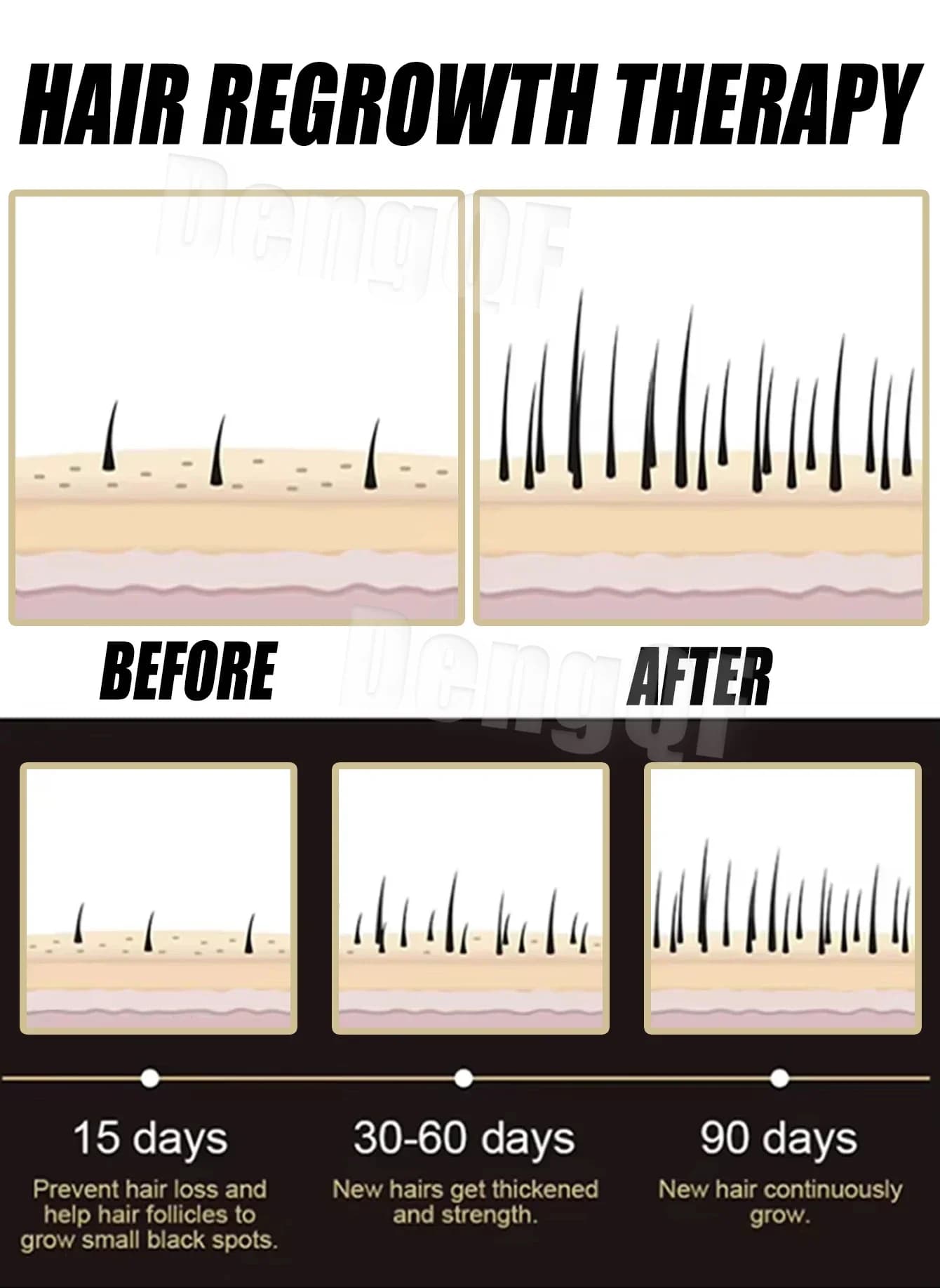 L'essence anti-chute de cheveux favorise la croissance de vos cheveux