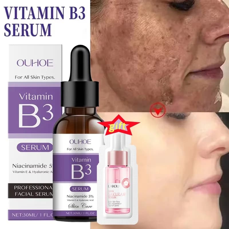 Sérum à la vitamine B3 pour estomper les taches brunes, le chloasma, éclaircir la pigmentation mélanique, lisser les pores, rajeunir, éclaircir et hydrater la peau