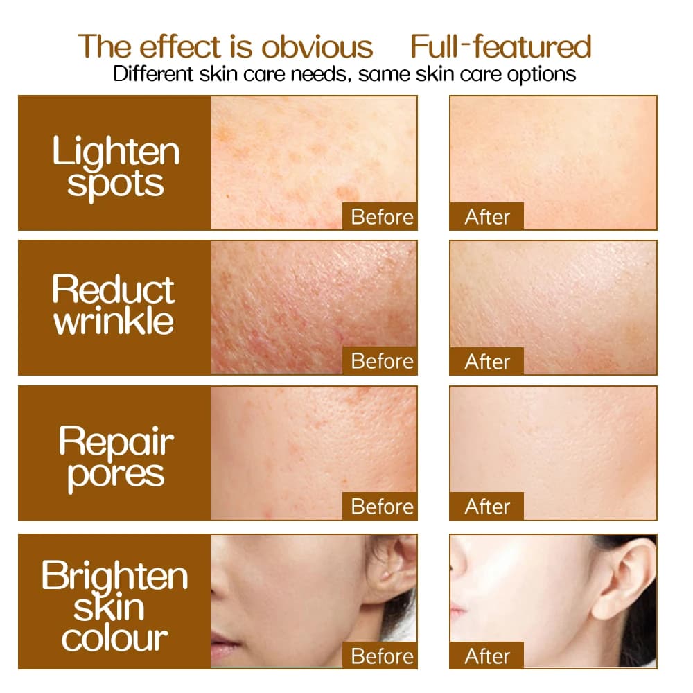 Rouleau de massage pour la peau avec micro-aiguilles, outil de beauté pour le visage, équipement pour la croissance des cheveux, l'élimination des rides et des cicatrices, le raffermissement de la pea