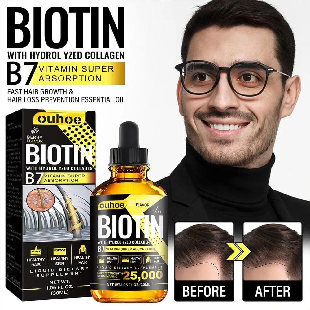 Sérum à l'huile de biotine pour la repousse rapide des cheveux, liquide de traitement pour l'amincissement des cheveux, anti-chute de cheveux pour femmes et hommes, Pro O5T7, nouveau, 2023