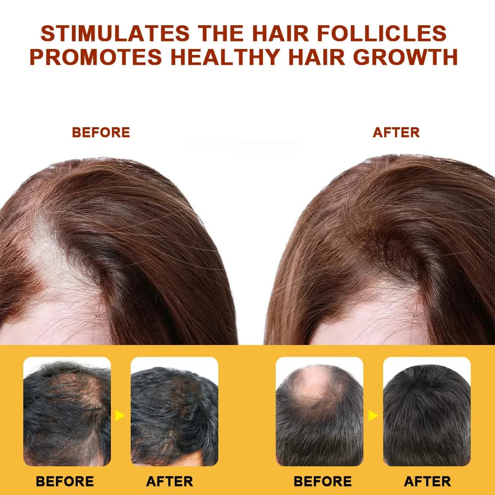 Crème sérum pour la croissance des cheveux, Capsule essentielle pour une repousse rapide, Anti-chute de cheveux, Traitement de la calvitie, Réduit les dommages du cuir chevelu, Pour femmes et hommes