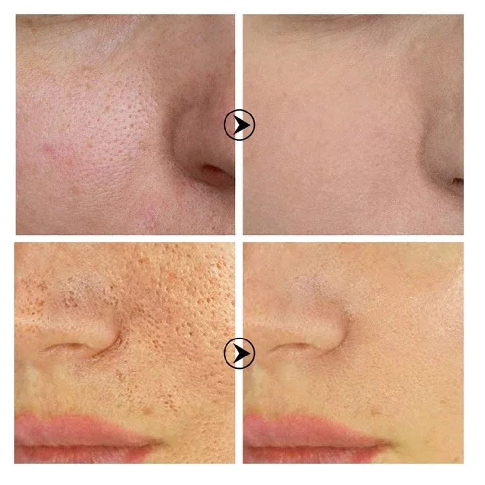 Skin Bergamo | Pore Refining Resurfacing, Sérum visage éclaircissant au rétinol et à la niacinamide non comédogène