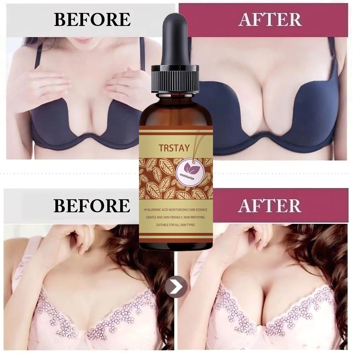5ML/15ML/30ML/50ML 100% huile essentielle naturelle pour le sein dodu pour augmenter