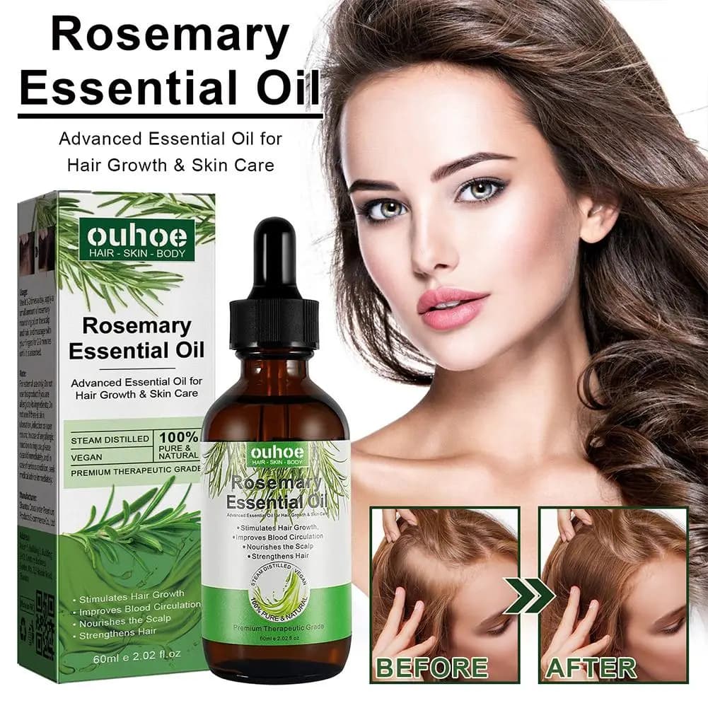 Huile de romarin pour la croissance des cheveux, huile essentielle de noix de coco, améliore la perte de cheveux et nourrit, renforce les racines des cheveux, traitement du cuir chevelu, soins capilla