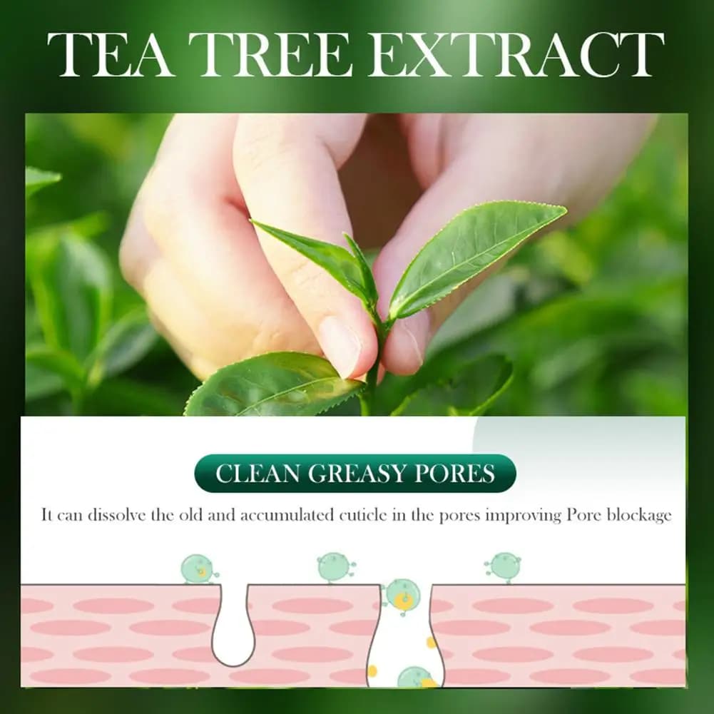SADOER arbre à thé crème anti-acné contrôle de l'huile GEL ANTI-ACNE nettoyage en profondeur hydratant soin de la peau du visage