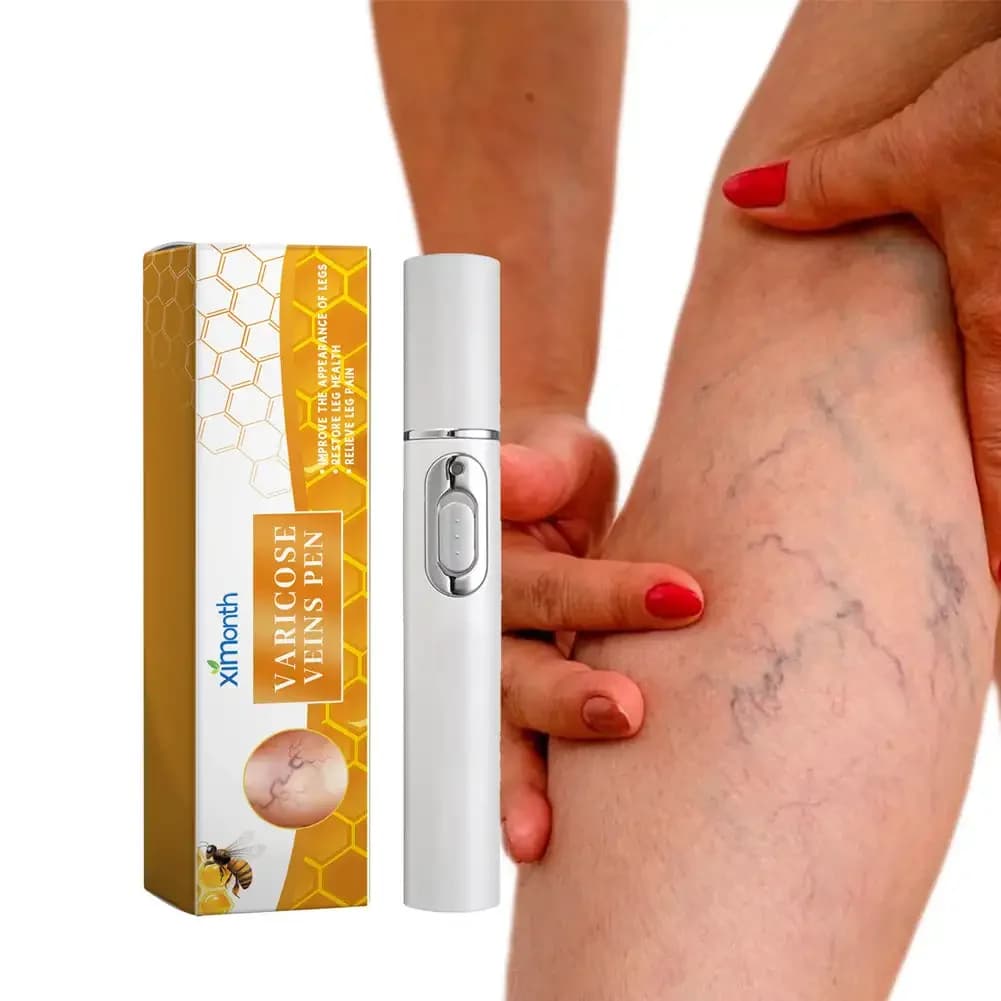 Abat-jour thérapie varices soulagement efficace de la vascularite dilatée dans les jambes phlébite améliorer la Circulation sanguine santé
