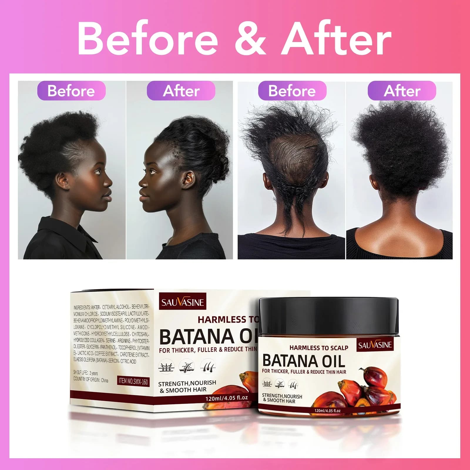 Huile de Batana brute pour la croissance des cheveux, 100% huile de Batana Pure et naturelle pour traiter la perte de cheveux, traitement Anti-casse