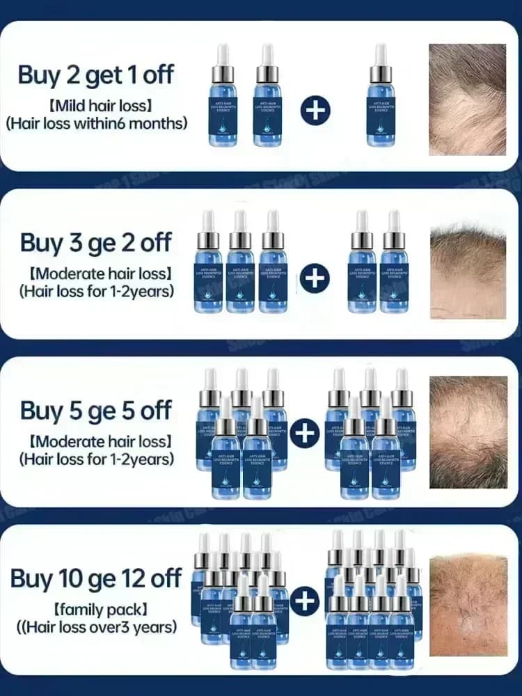 2 Sérum de croissance des cheveux et anti-chute de cheveux