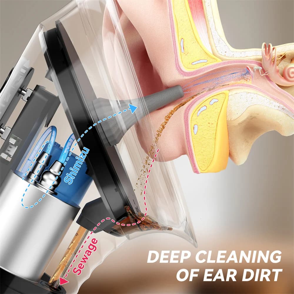 Élimination améliorée du cérumen avec réservoir d'eau usée, nettoyeur d'oreille de sécurité avec capteur de température de l'eau, Kit d'irrigation auditive efficace