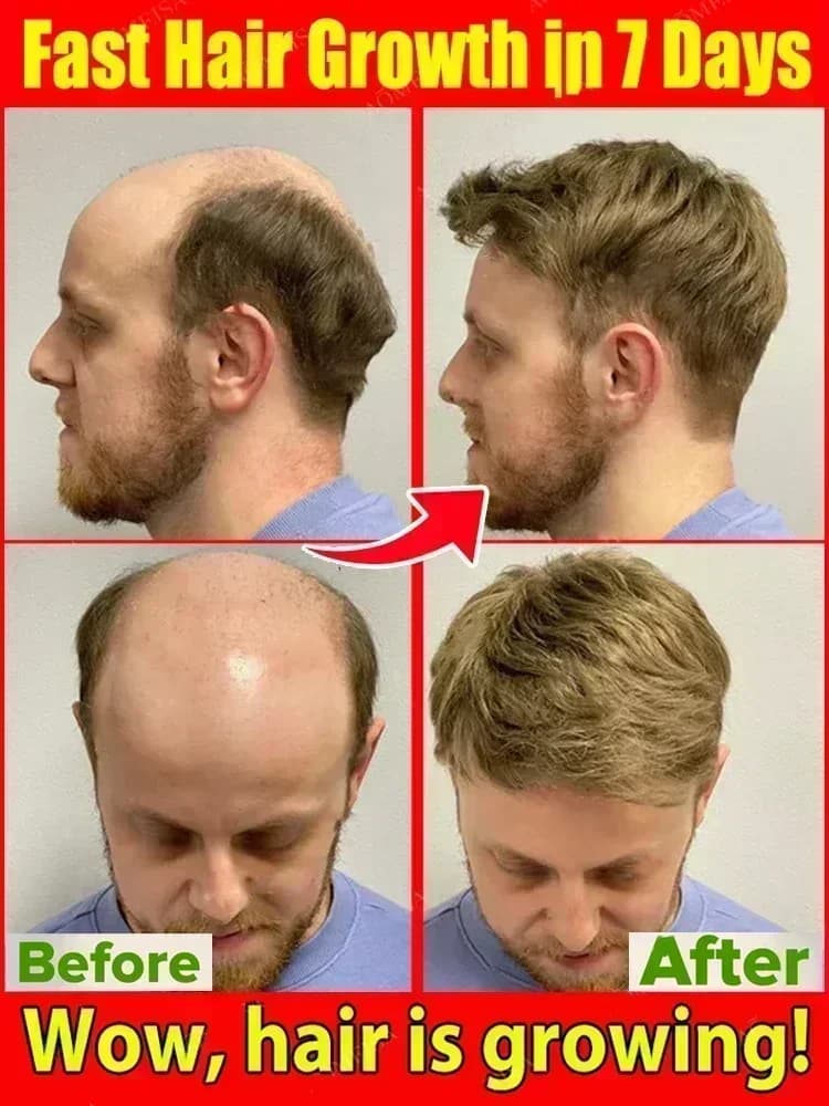 Traitement Essentiel de Repousse et de Croissance des Cheveux