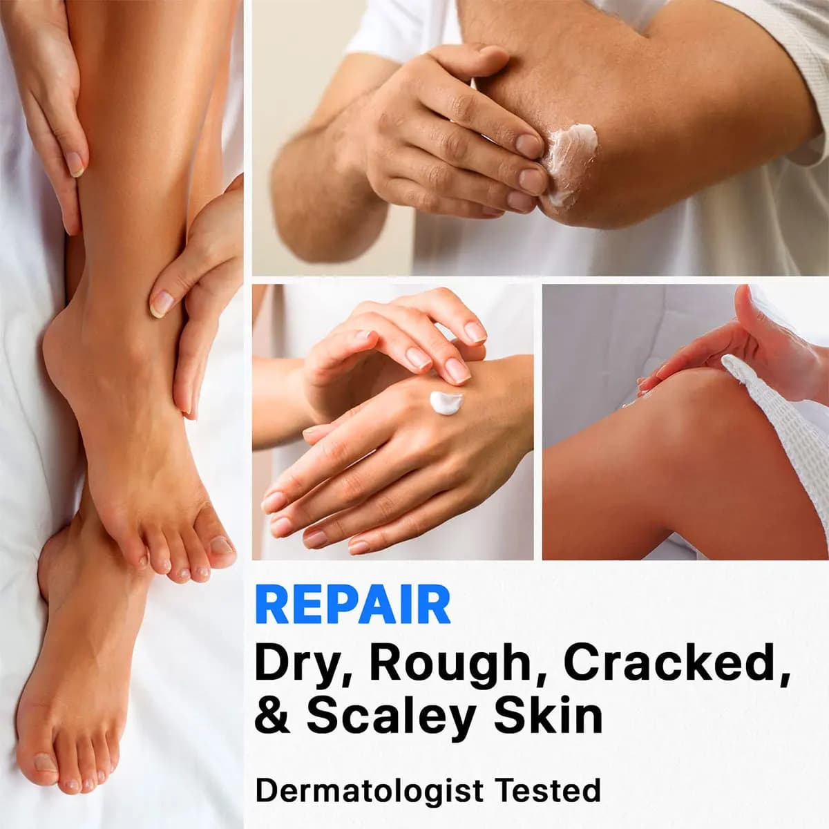 Crème pour les mains à l'urée et à l'acide salicylique, contenant de l'huile d'arbre à thé, de l'urée, d'acide salicylique et d'aloe vera, hydrate les mains et les pieds