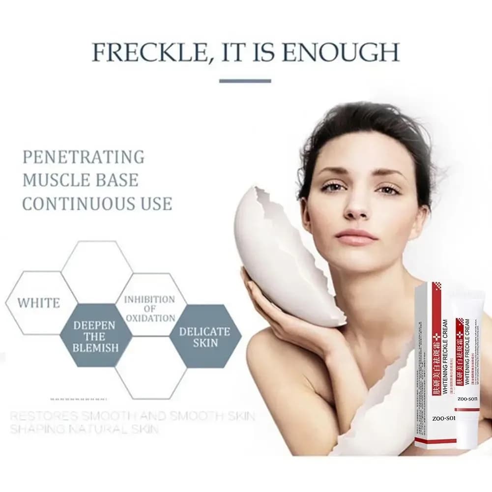 Crème blanchissante anti-taches de rousseur pour le visage, élimine les taches foncées, estompe la pigmentation, niacinamide, éclaircit le mélasma, soins de la peau, 20g