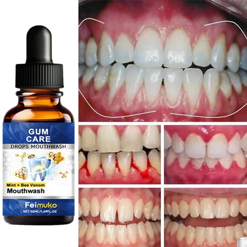 Essence réparatrice pour gencives endommagées, soulage les gencives sensibles, atténue l'atrophie et l'enflure, réduit les saignements, combatt la mauvaise haleine, blanchit les dents, améliore la san