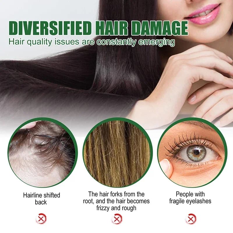 Huile de ricin noire organique pour la croissance des cheveux, collecte des cheveux denses du cuir chevelu, prévention de la perte de cheveux, réparation liquide nourrissant