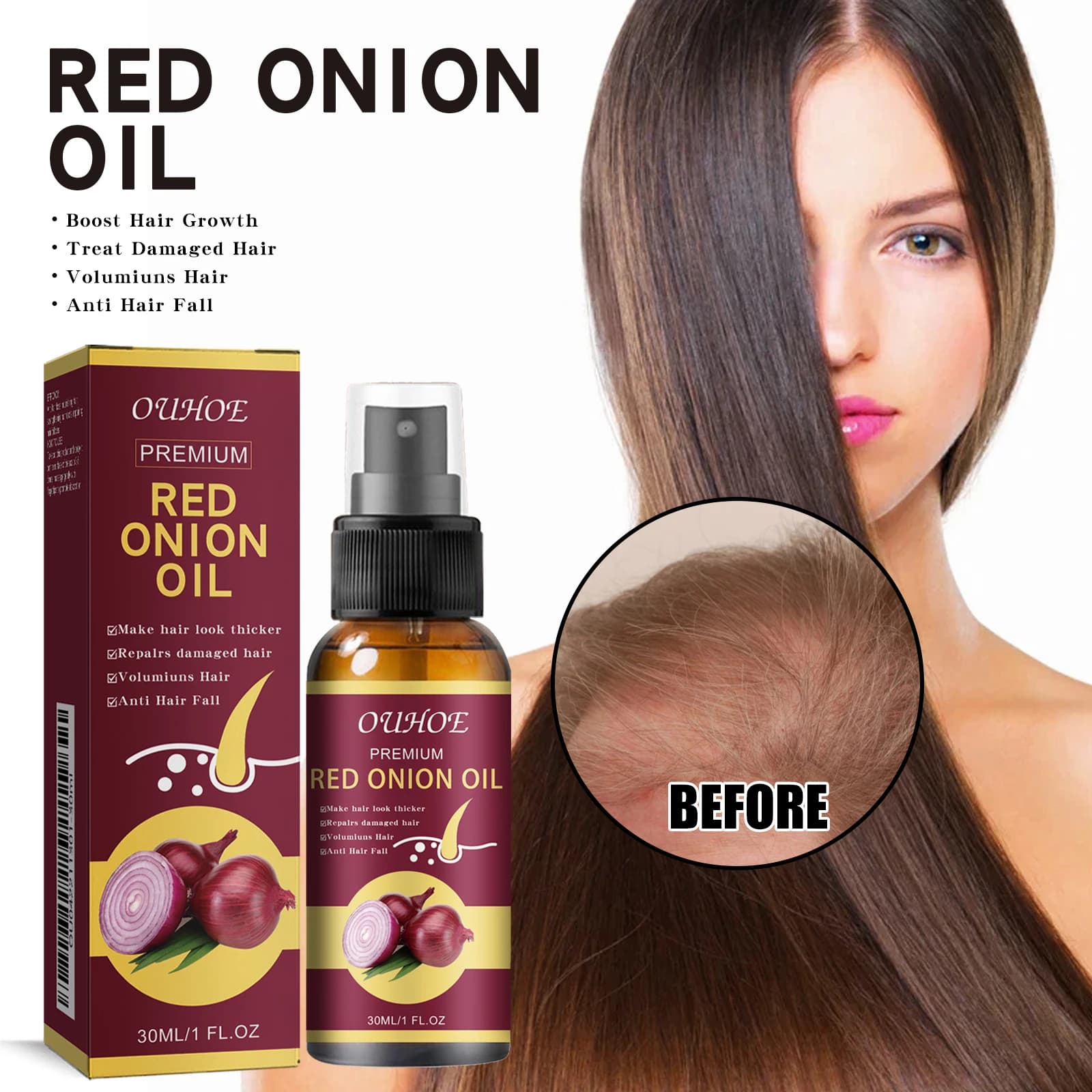 Huile essentielle pour la croissance des cheveux à l'oignon rouge, spray pour soins capillaires, prévient la perte de cheveux, nourrit les racines des cheveux, améliore la texture des cheveux, produit