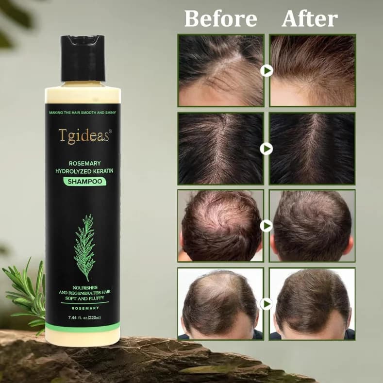 Shampooing bio à la rosemary Tgideas, kératine hydrolysée, nourrit le cuir chevelu, réduit la chute des cheveux, shampooing unisexe pour cheveux secs et fragiles