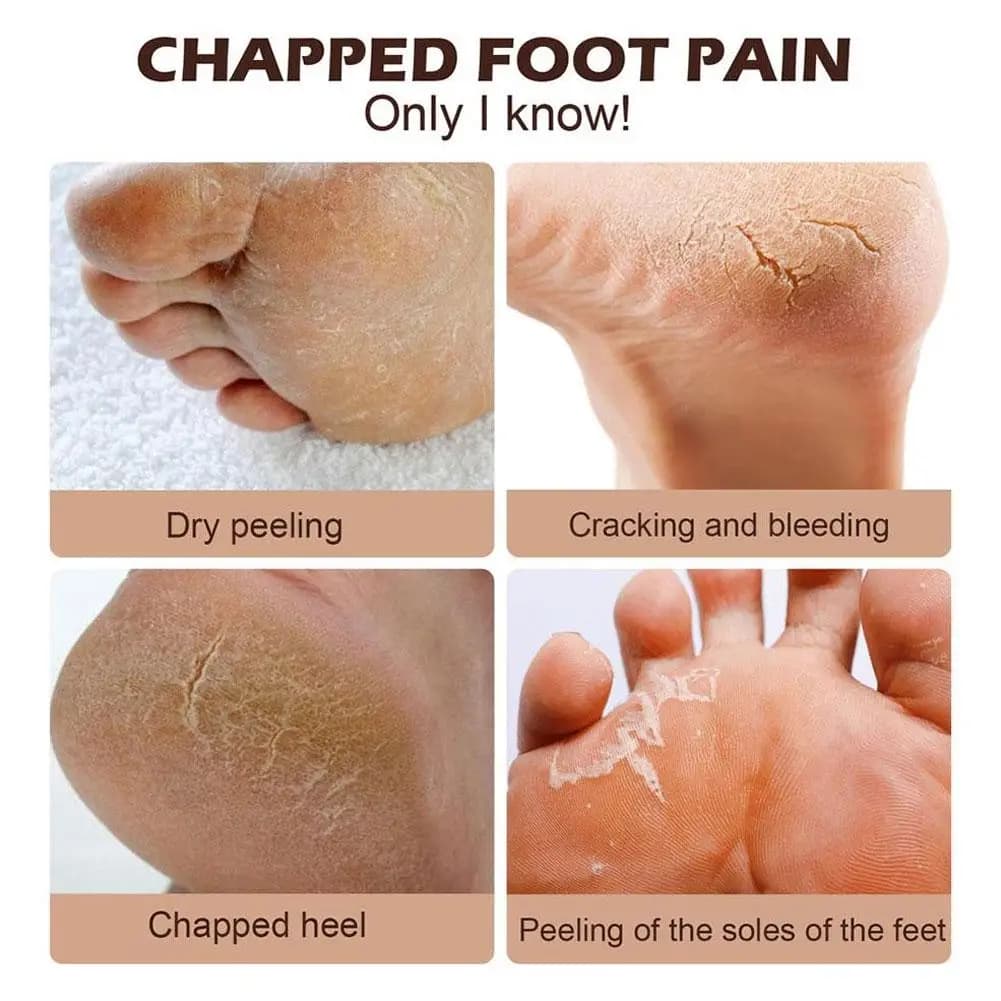 Crème hydratante pour les mains et les pieds à l'huile de cheval 300g Laolishi, lotion hydratante pour le corps, soin des mains, anti-fissures, anti-dessèchement 300g