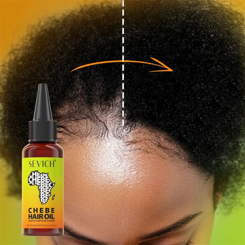Huile de croissance rapide des cheveux Chebe