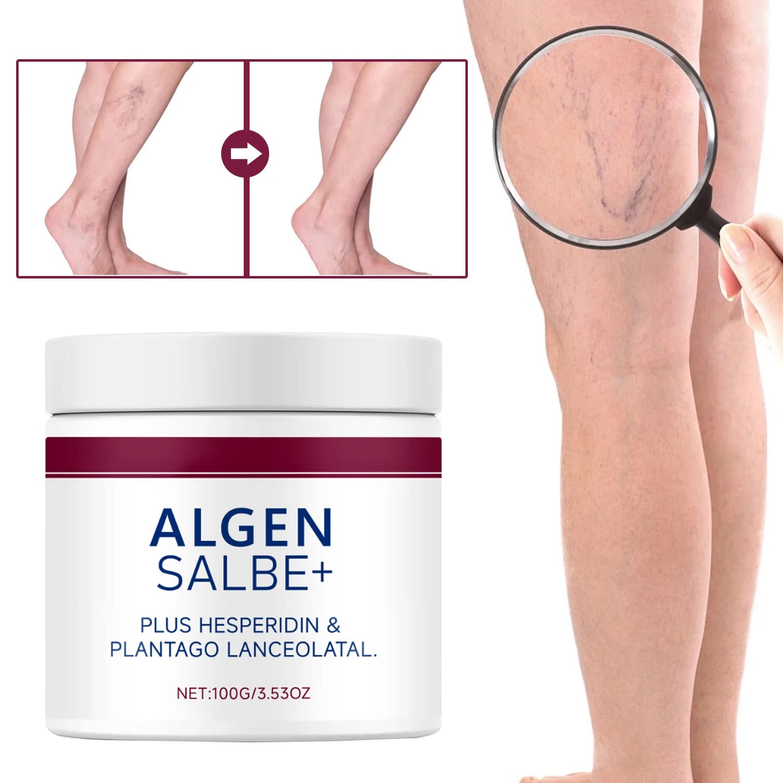 Crème Réparatrice Apaisante pour Veines 100g – Soulagement des Varices, des Gonflements et des Bosses Douloureuses des Jambes – Sans Étiquette – Couverture Externe Incluse