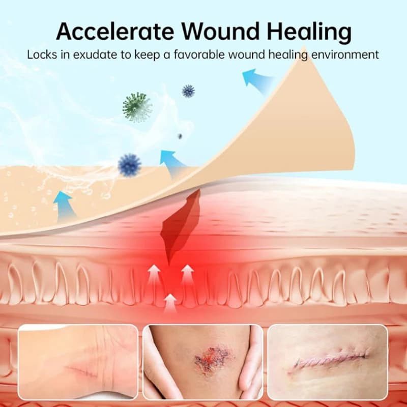 Super ! Rouleau d'hydrocolloïdes pour soins des plaies